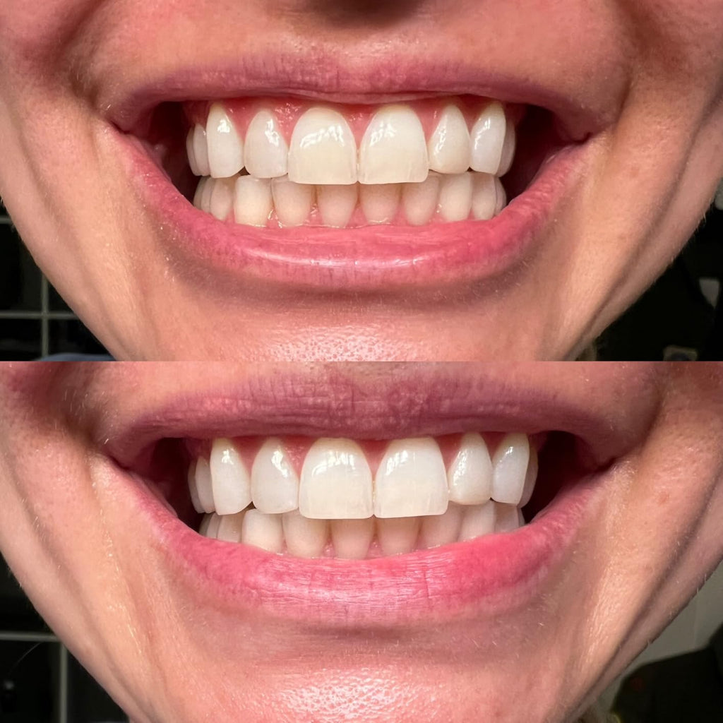 PurelyWHITE | Teeth Brightening Powder