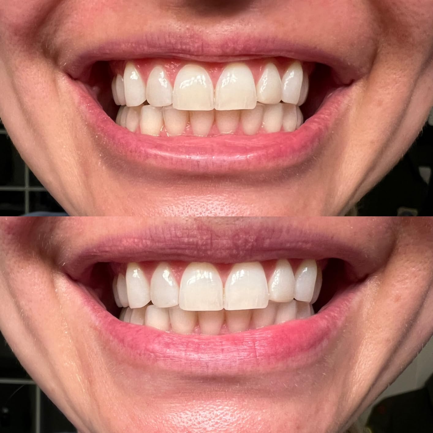 PurelyWHITE | Teeth Brightening Powder